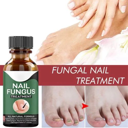Fast Nail Repair Anti-Fungal Treatment Serum
