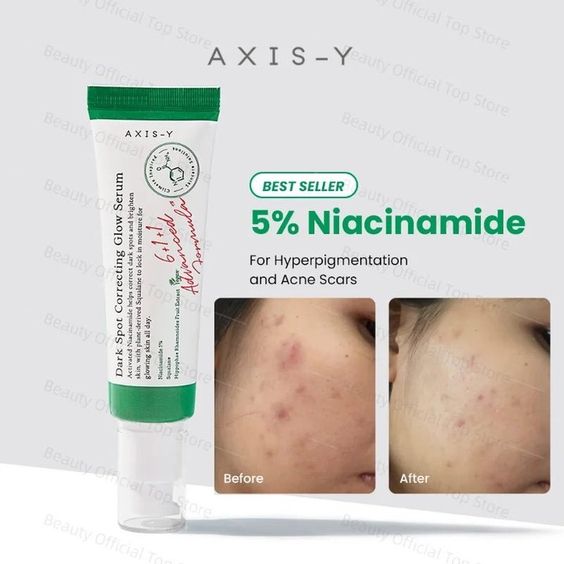 AXIS-Y Dark Spot Correcting Glow Serum – Niacinamide Brightening Treatment for Fading Hyperpigmentation, Hydrating & Evening Skin Tone