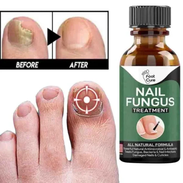 Fast Nail Repair Anti-Fungal Treatment Serum